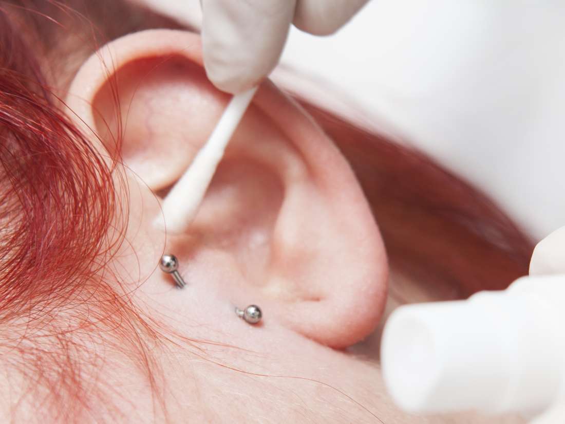 Piercing Near Me Infected Bump On Ear Lobe Piercing 