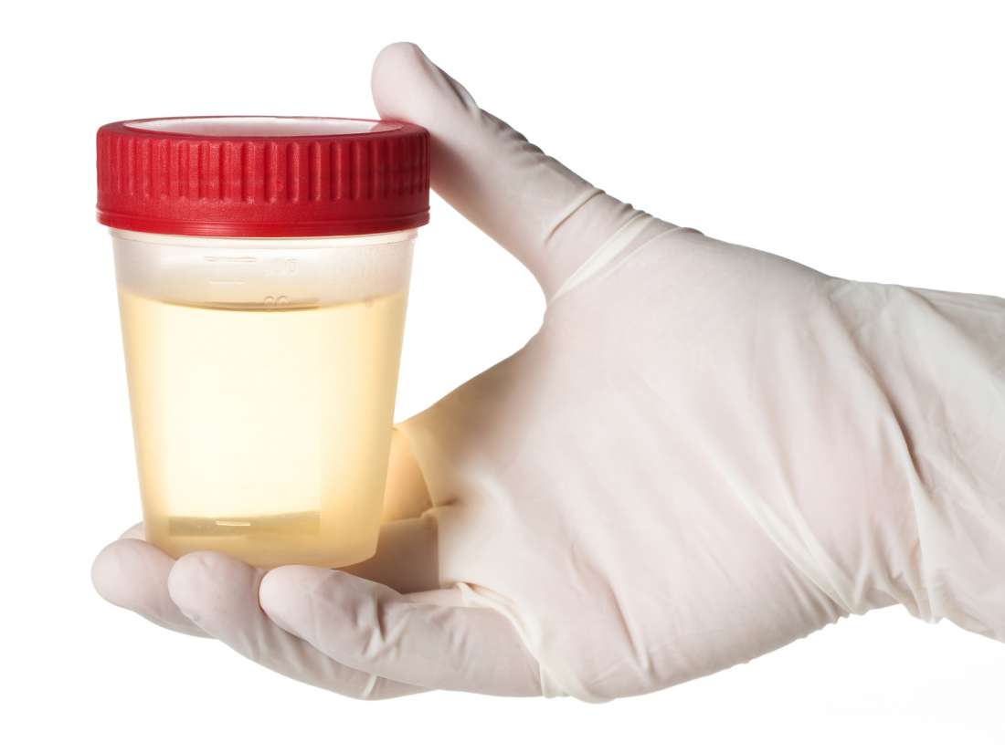 urine-smells-like-ammonia-causes-treatments-and-symptoms