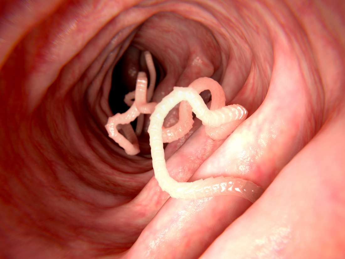 pin worms in humans