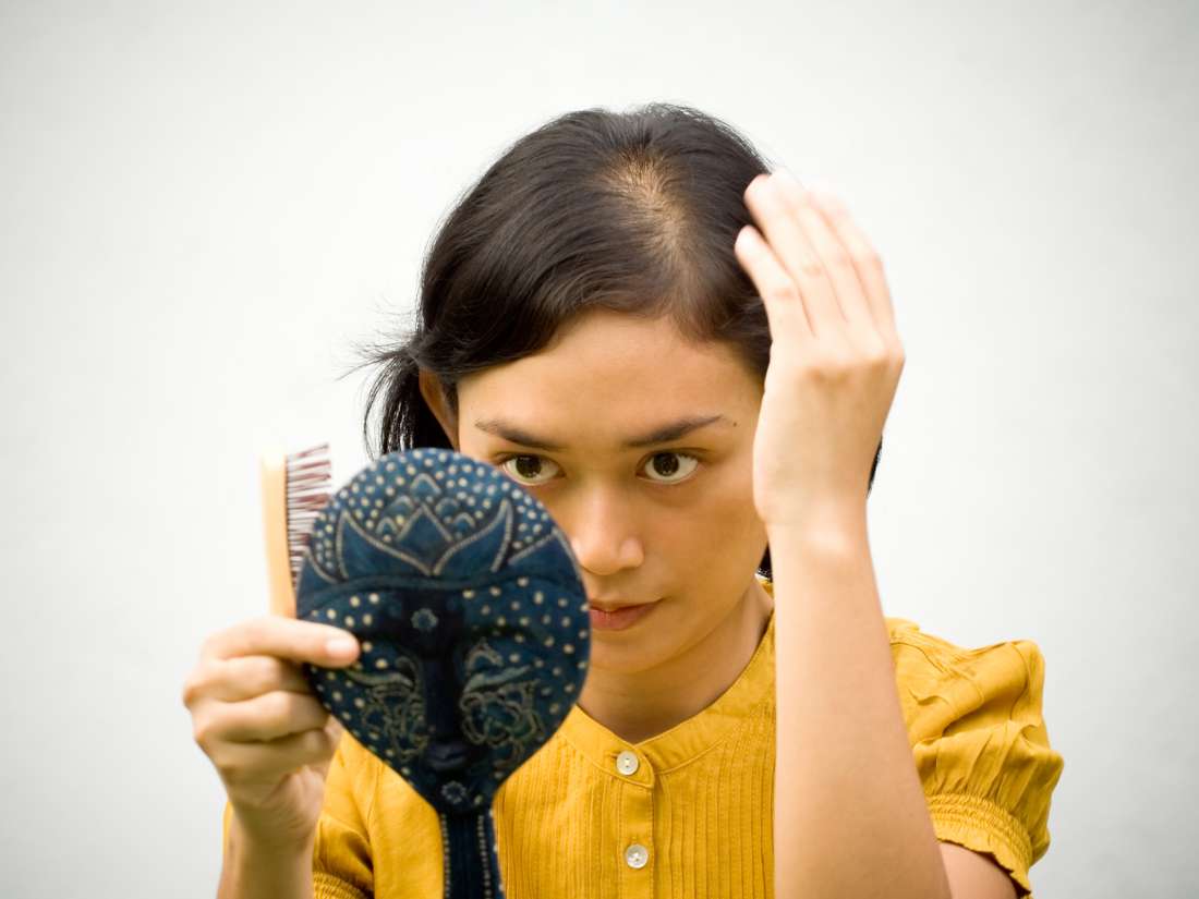 Iron Deficiency Hair Loss Symptoms Treatment And Regrowth
