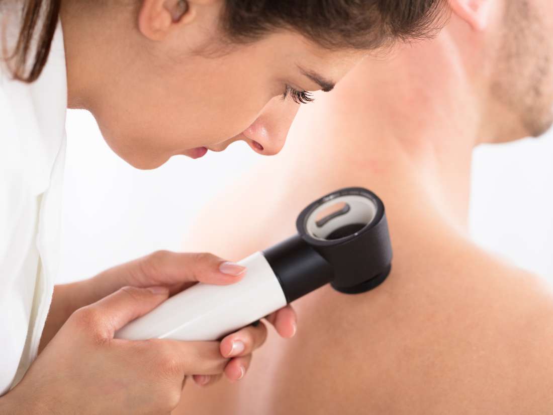 Weight Loss Reduces Skin Cancer Risk