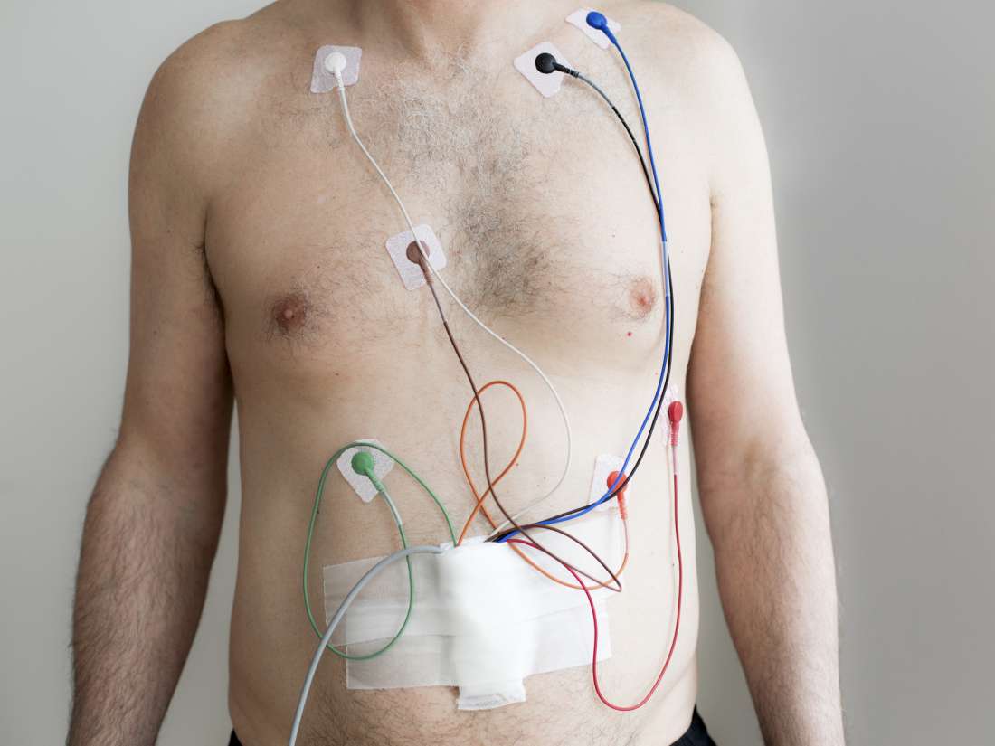 24-hour-holter-monitoring-uses-results-and-what-to-expect