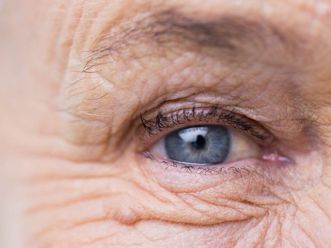 Do eye wrinkles make us appear more sincere?