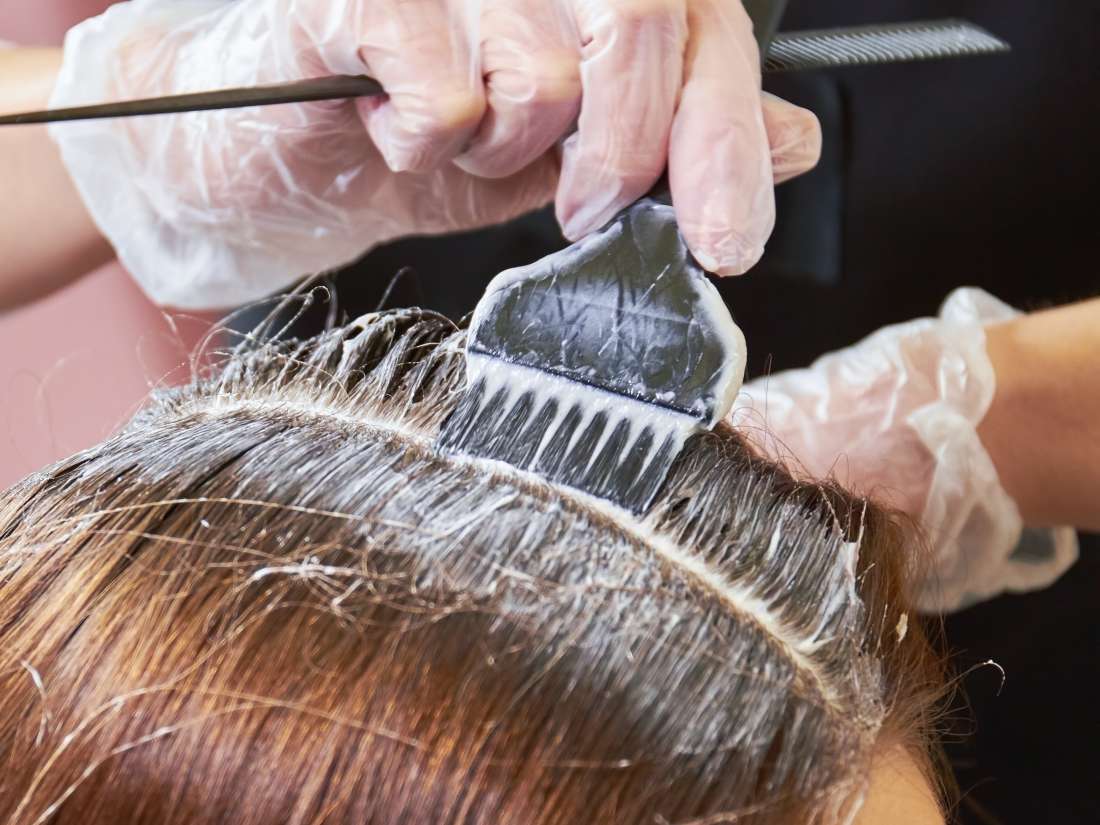 Dyeing Hair When You Have Psoriasis Tips For Staying Safe