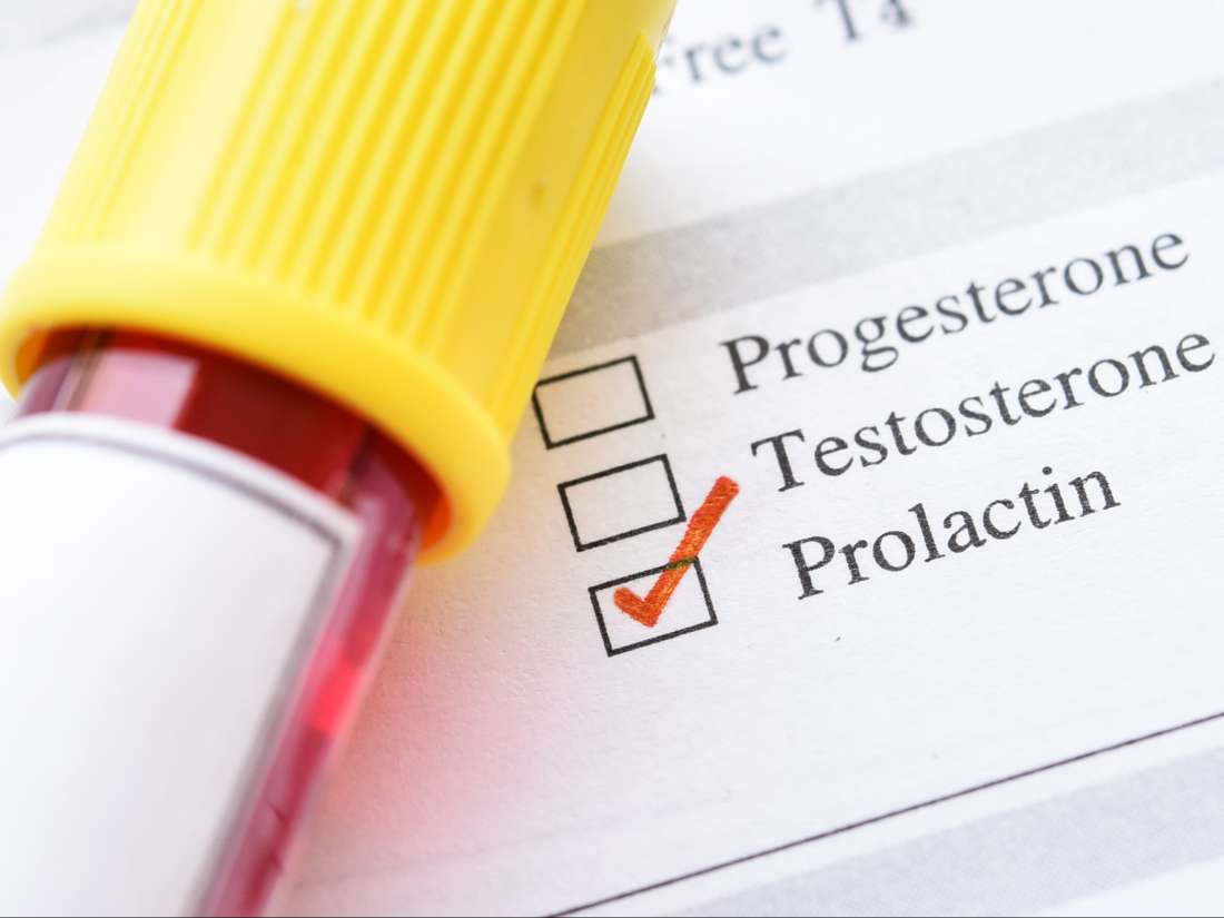 Prolactin Level Test High Levels Low Levels And When To Measure