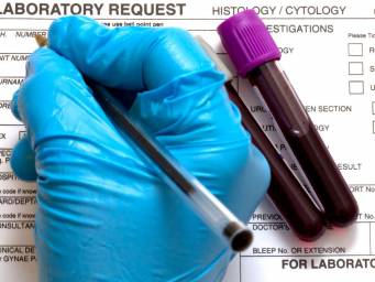 mpv blood test normal range