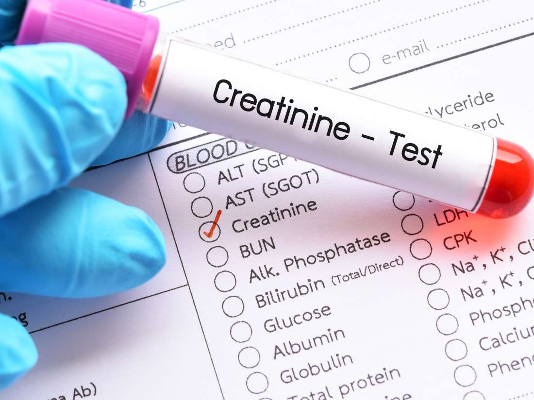 Creatinine Blood Test Purpose Procedure And Low Or High Ranges