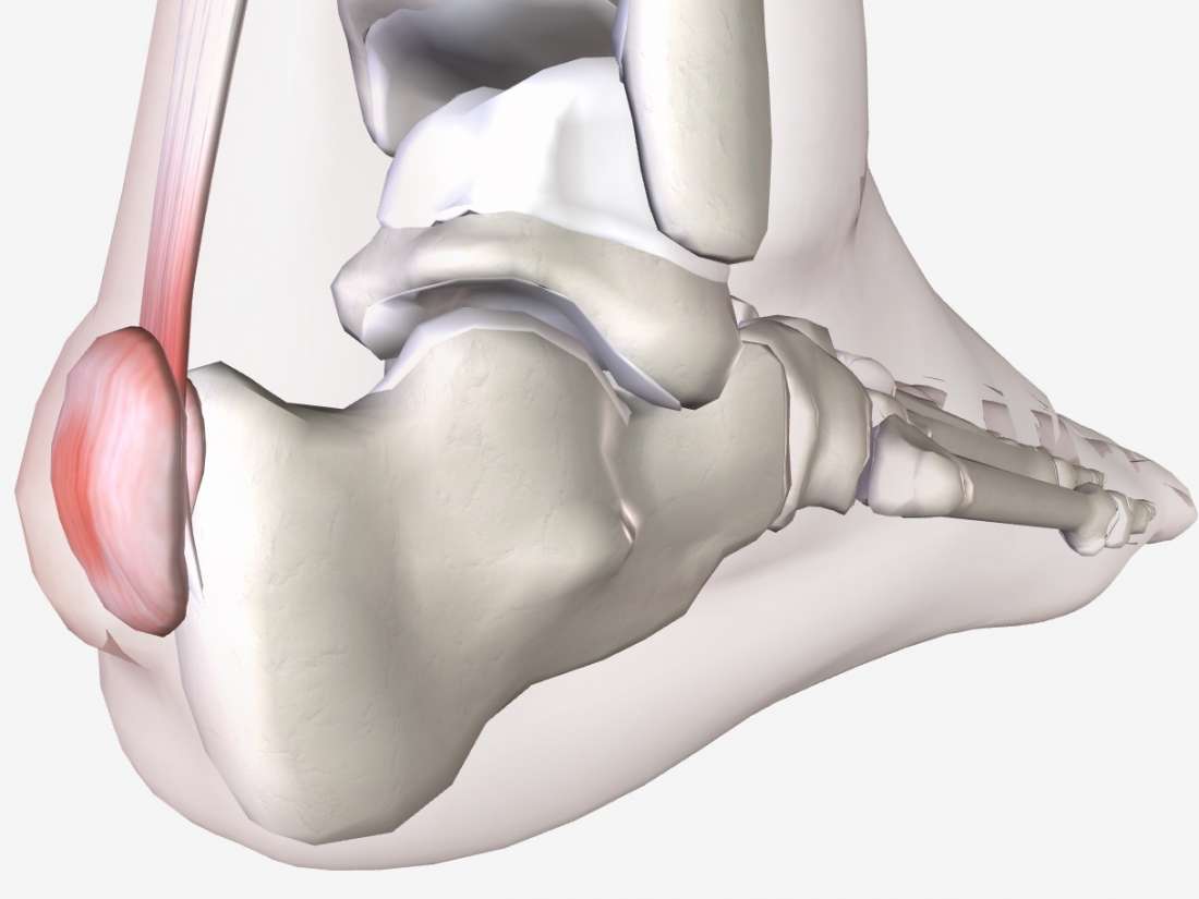 ortho-dx-deformity-of-the-ring-finger-clinical-advisor