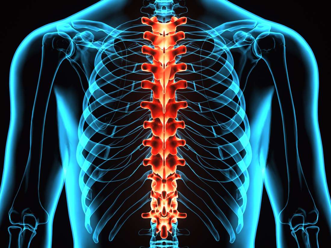 Spinal stroke: Symptoms, causes, recovery, and prognosis