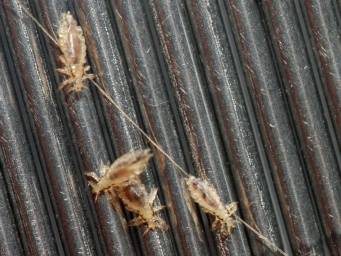 Lice bites: Pictures, identification, and treatment