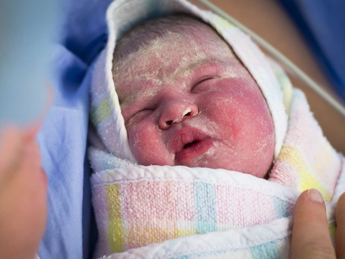 How To Get Rid Of Dry Skin On Newborn Head