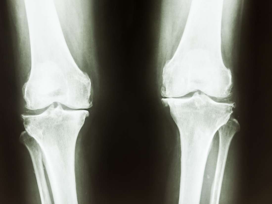 a-soy-based-diet-could-help-strengthen-bones