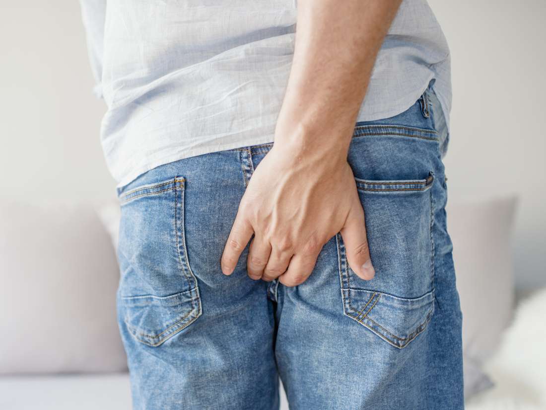 External Hemorrhoids Causes Symptoms And Treatments