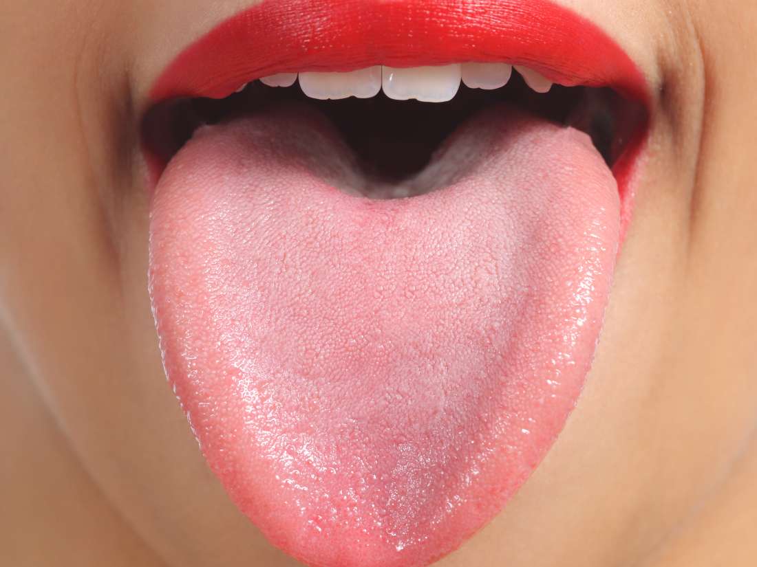 Red Spots On Roof Of Mouth Causes And Other Symptoms