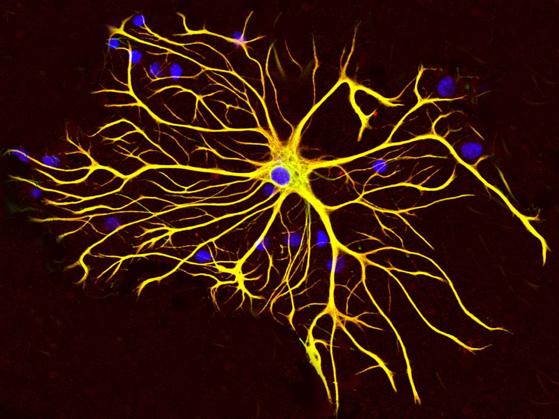 brain-cell-identified-as-mediator-of-disease