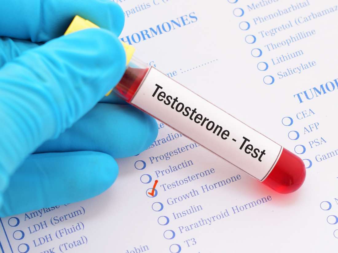 Healthy Testosterone Levels Chart