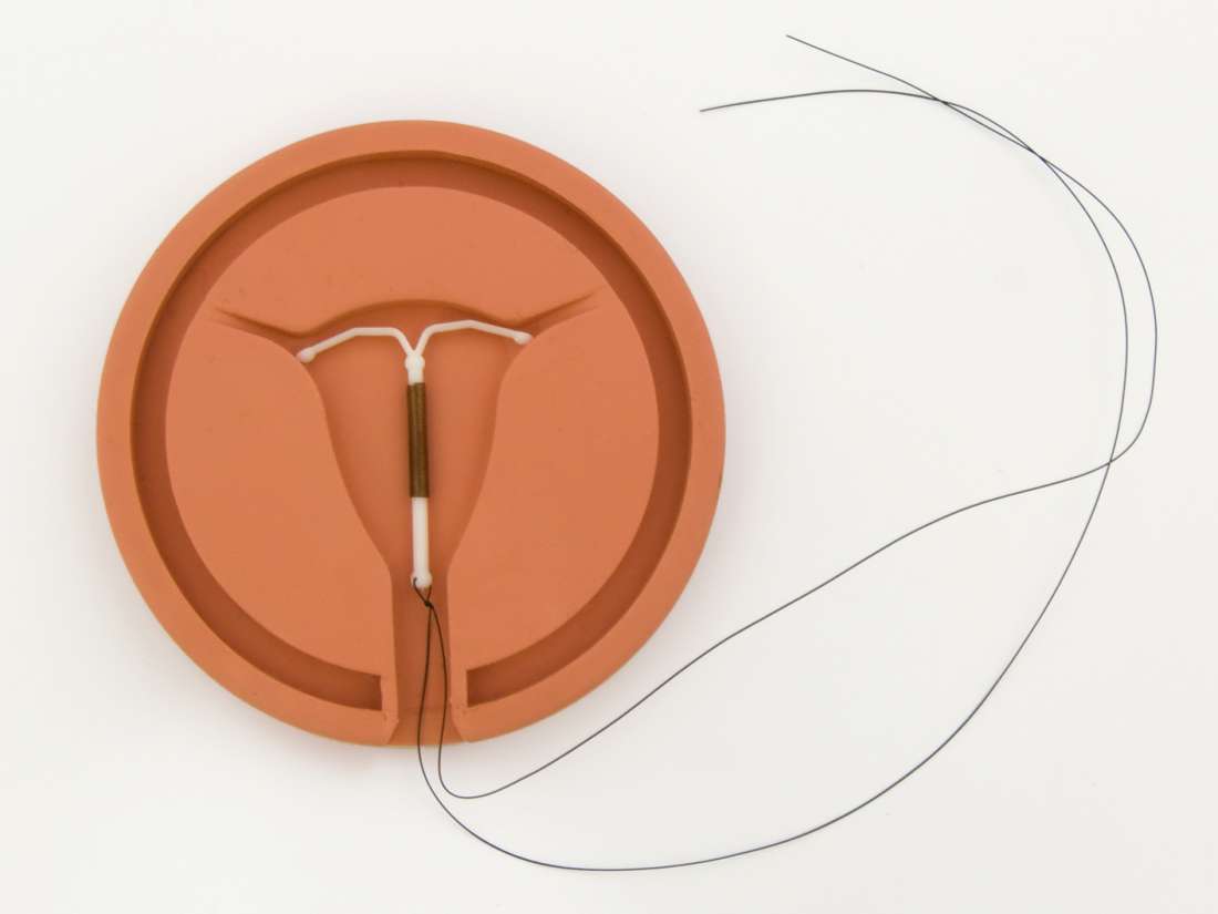 copper iud side effects