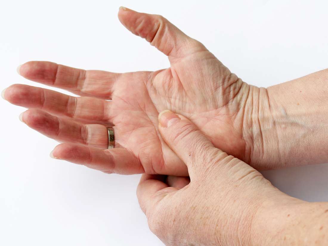 What Are Rheumatoid Markers