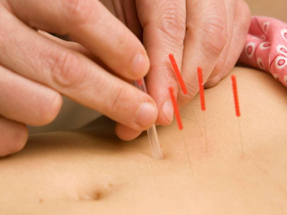 Acupuncture Points For Fertility Chart