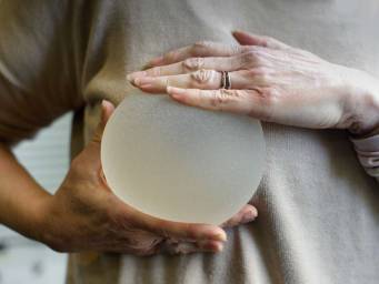 The long-term outcomes of breast implants studied