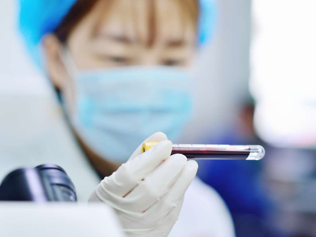 New blood test can detect ovarian cancer in its early stages