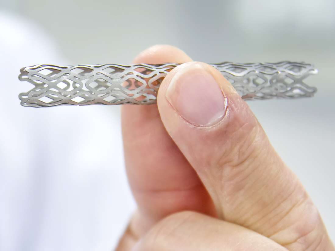 what-is-a-stent-uses-risks-and-recovery