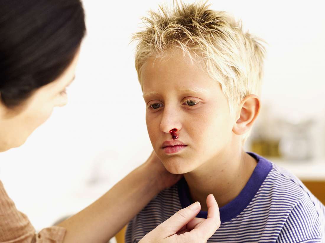 covid symptoms in kids bloody nose