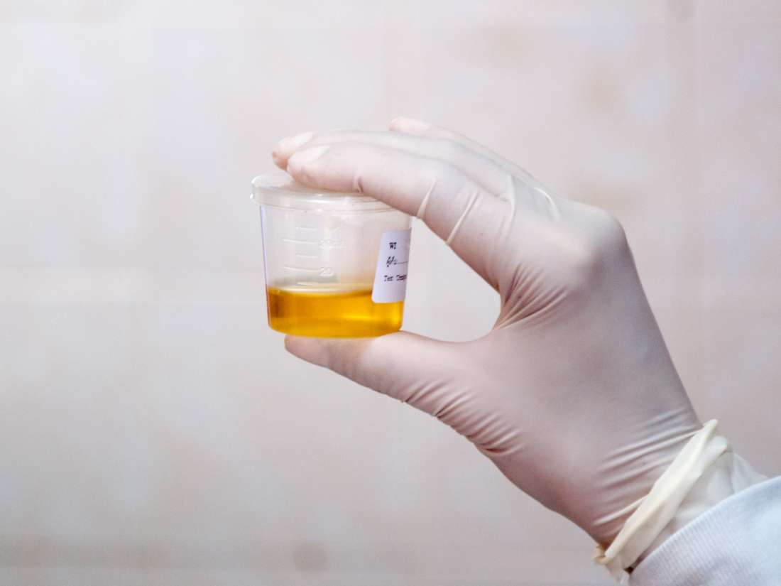 Low Urine Output Causes And Treatments