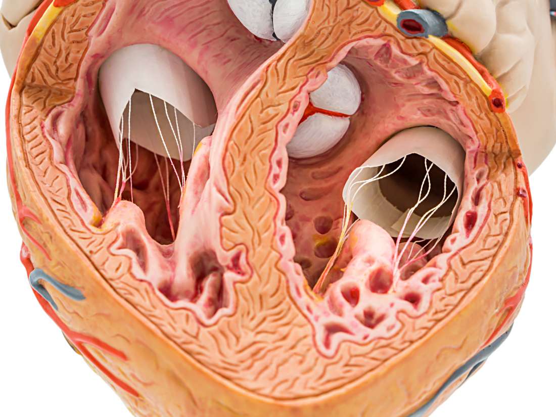 how-calcium-in-coronary-arteries-can-predict-future-heart-health