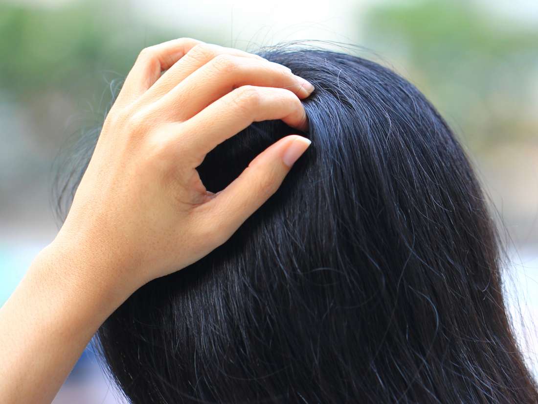 Tingling Scalp Causes Symptoms And Treatment