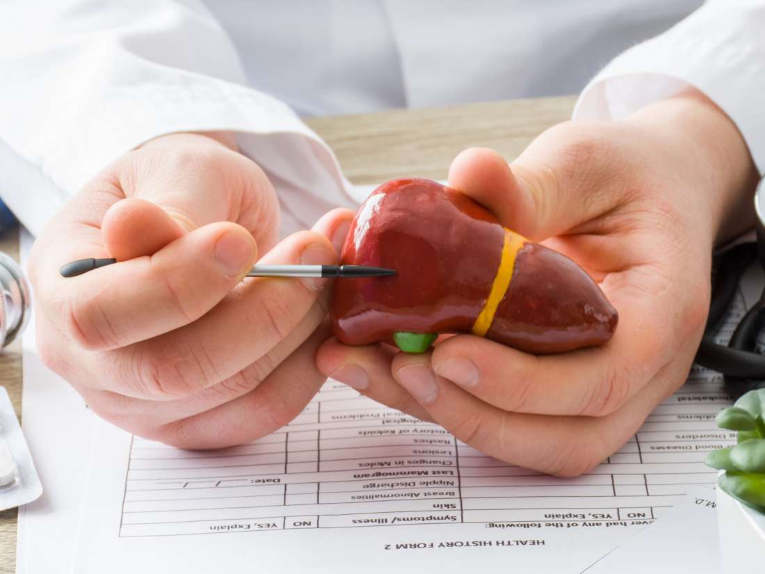 Elevated Liver Enzymes Causes Symptoms Tests And Treatment