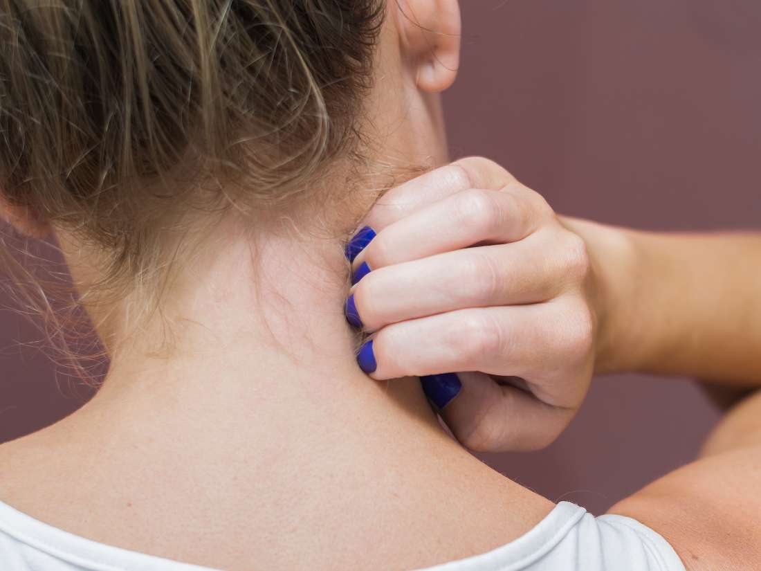 itchy-neck-causes-remedies-and-prevention