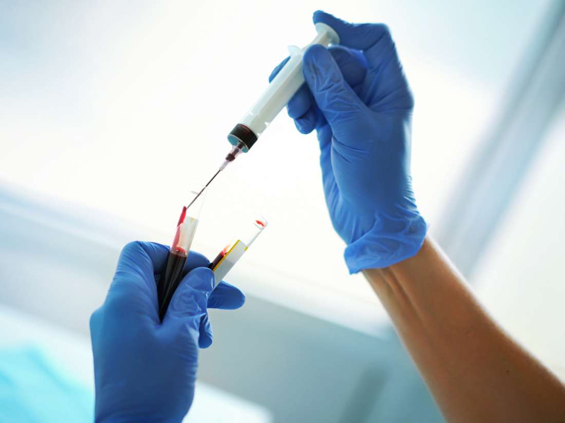 Study finds 'disturbingly' high levels of 'ugly cholesterol'