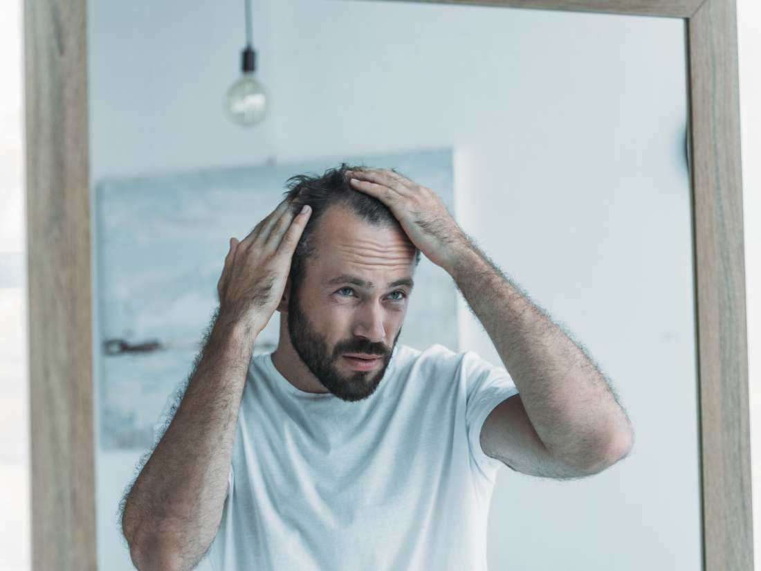 How air pollution may lead to hair loss