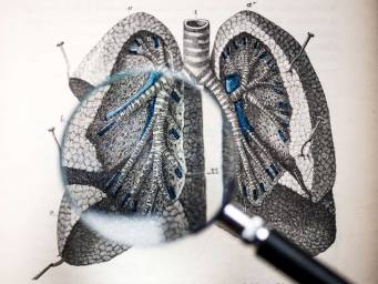 First-time evidence suggests that fat can accumulate in the lungs