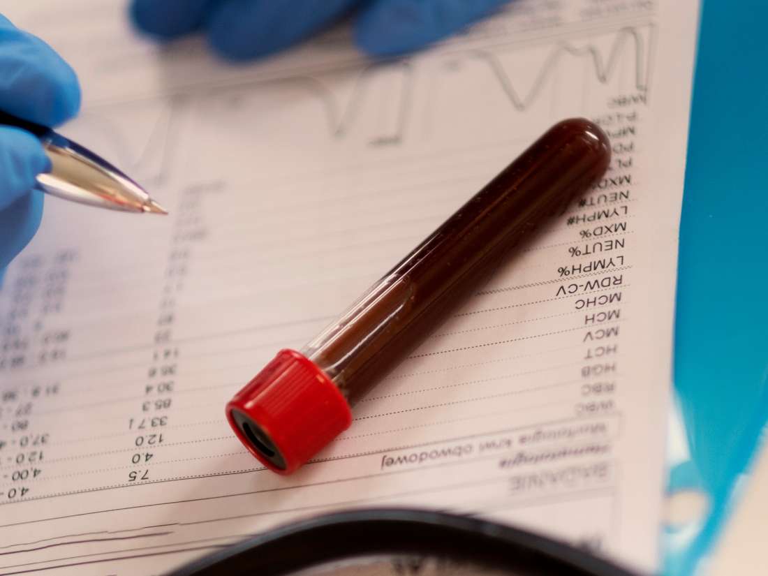 How Long Can Blood Test Results Take