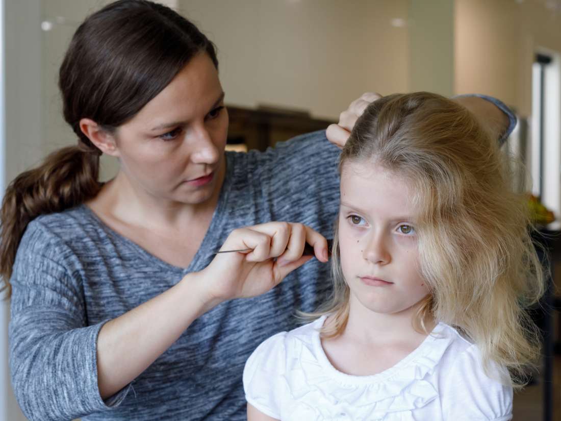 Hair Loss In Children Causes Other Symptoms And Treatments