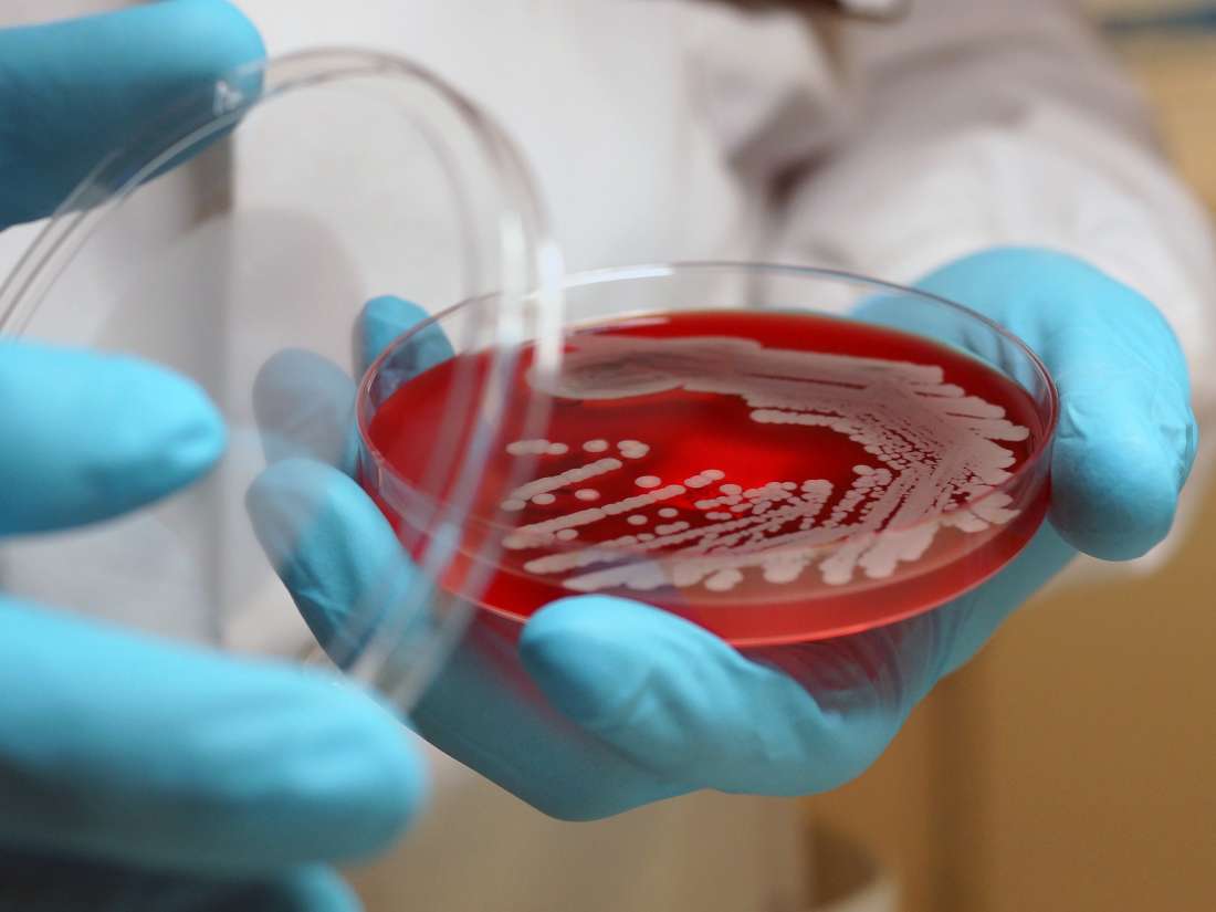 Superbugs: Everything you need to know