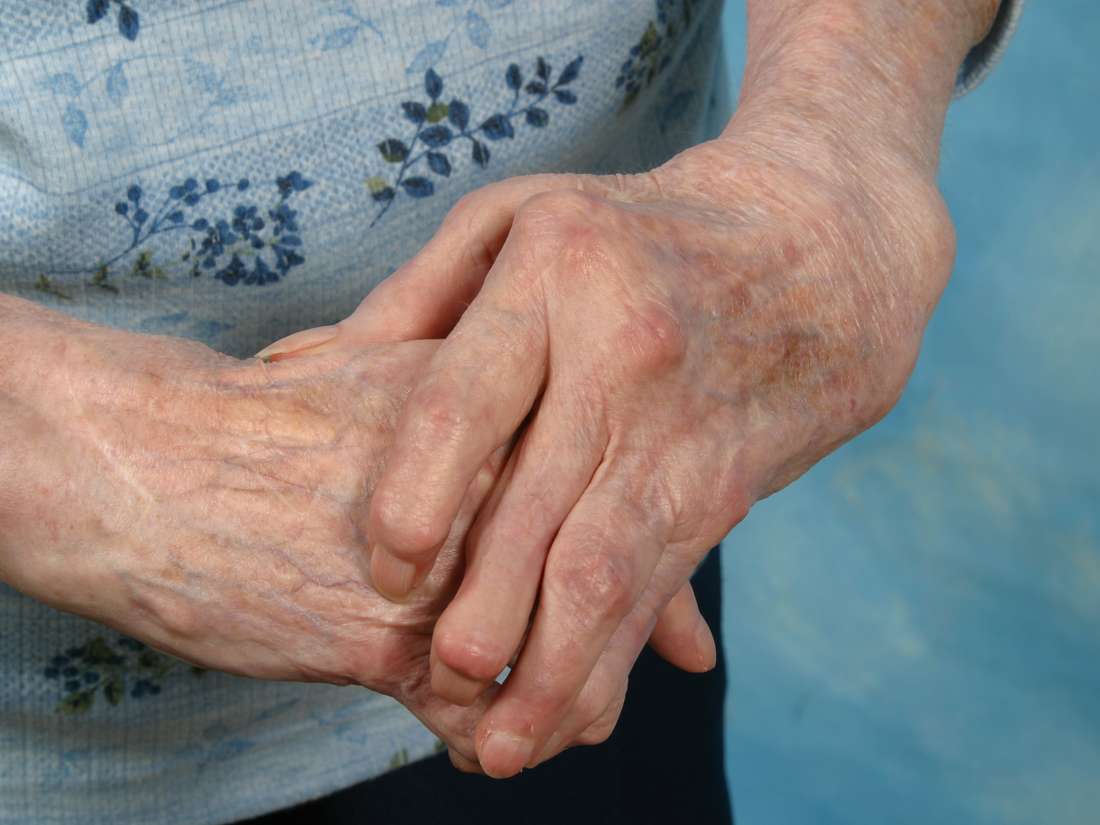 me duele el dedo pulgar mano izquierda