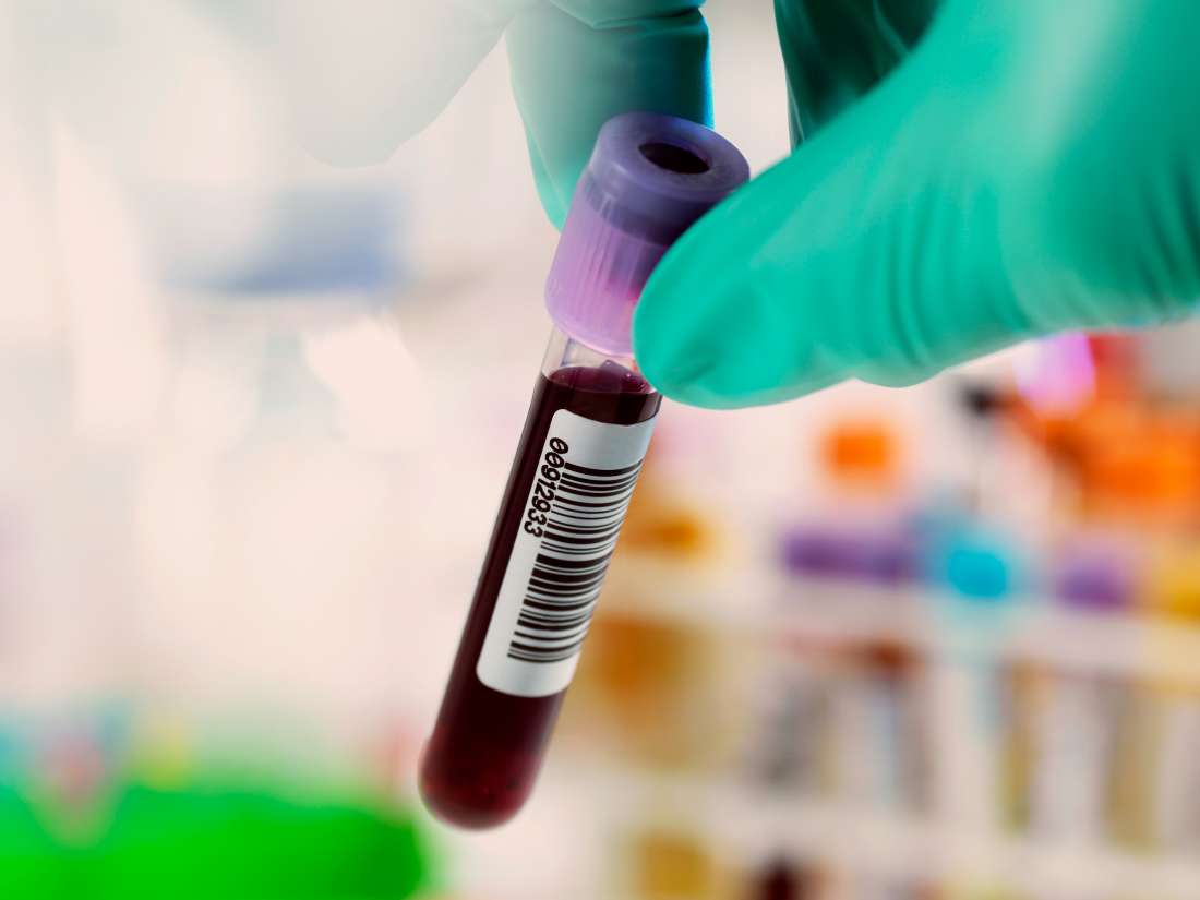 What to know about false positives in hepatitis C testing