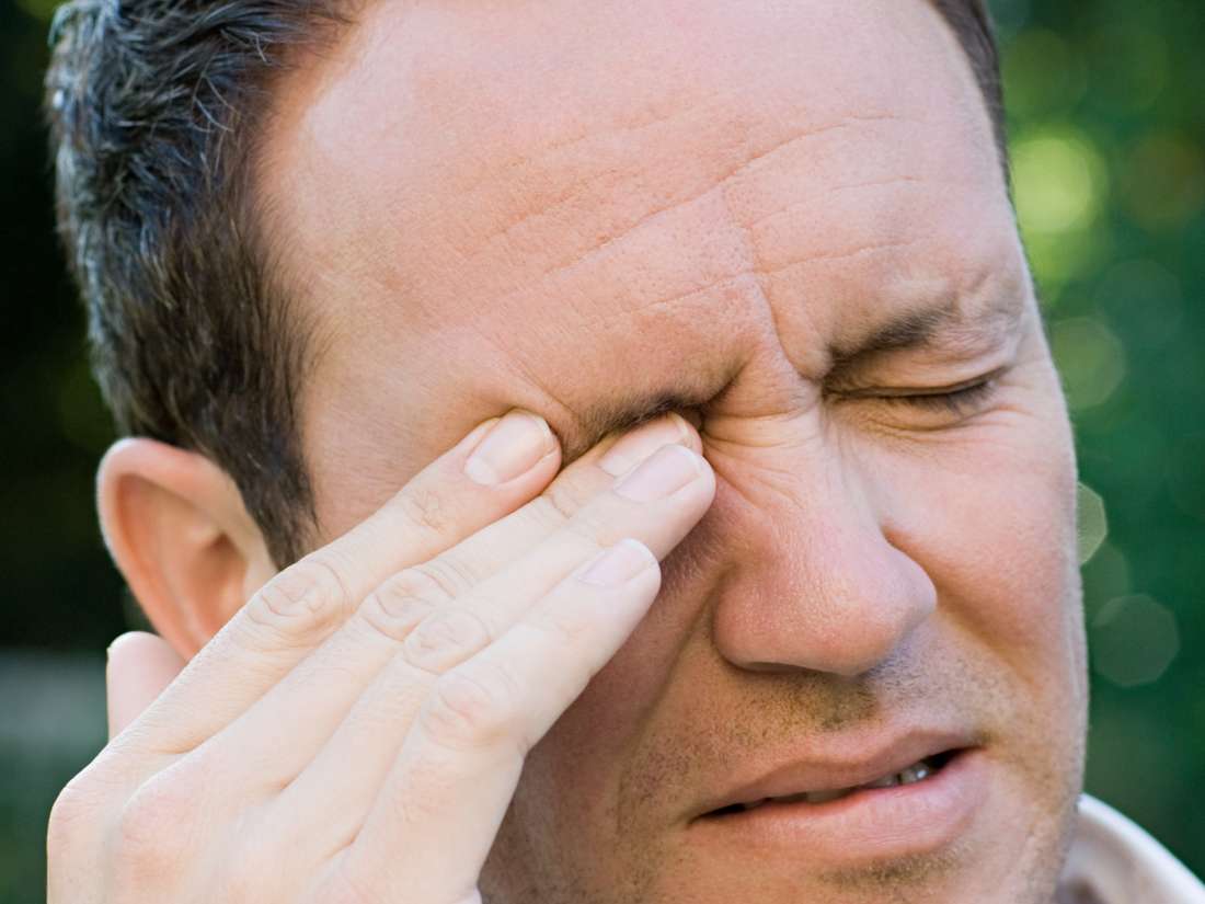 Blocked Tear Duct In Adults Causes Symptoms And Treatment